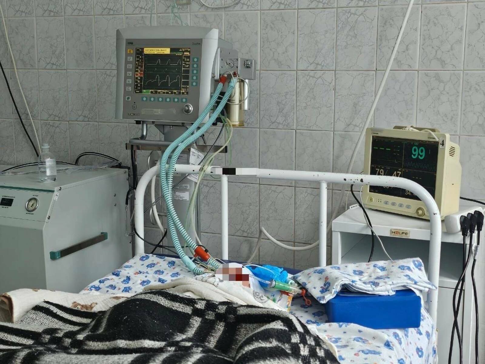 В Башкирии младенец из-за «бытовой ситуации» получил множественные травмы