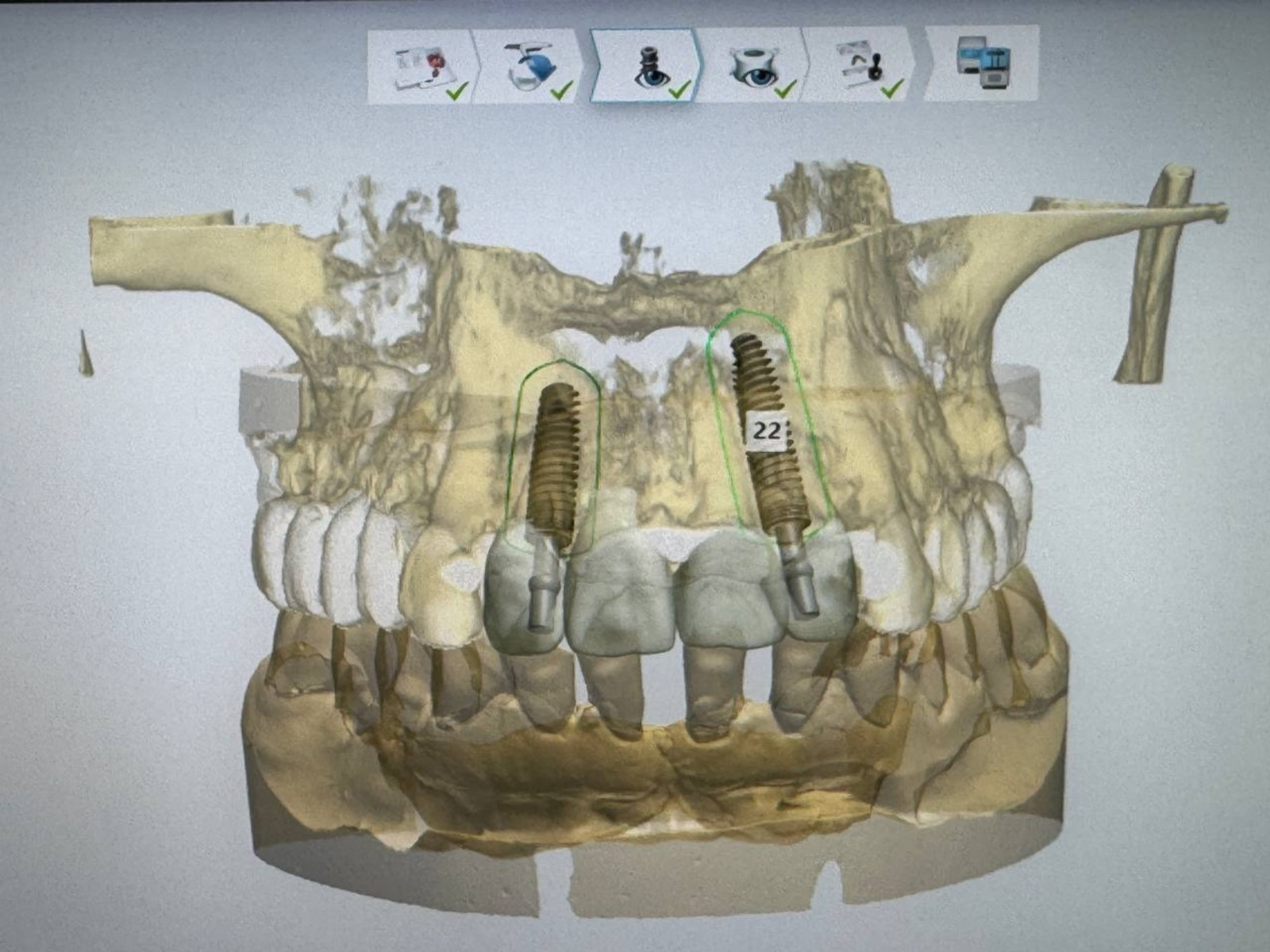 В Башкирии изобрели «GPS для зубов»: революция в стоматологии уже началась