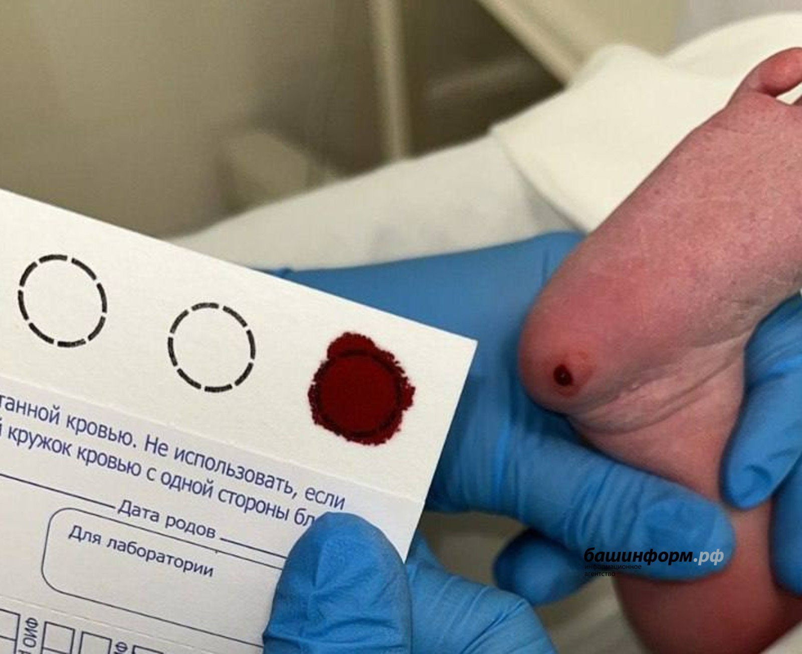 В Башкирии выявлены очень редкие заболевания