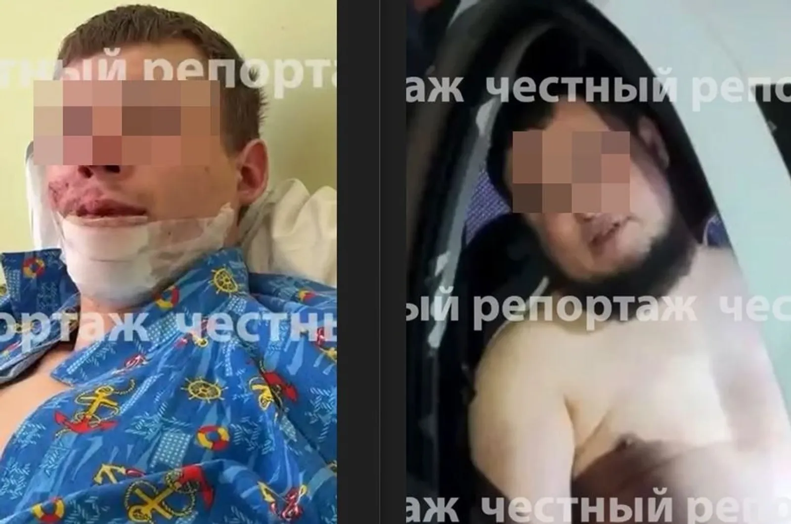 Пьяный водитель жестоко избил уфимца